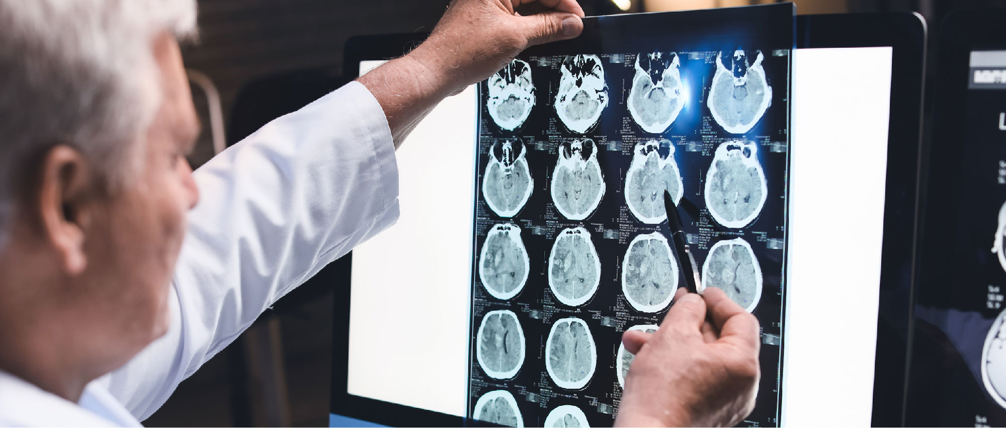 Arzt untersucht Gehirnscans, die Bedeutung des Gehirntrainings durch regelmäßiges Tragen von Hörgeräten. Arzt untersucht Gehirnscans, die Bedeutung des Gehirntrainings durch regelmäßiges Tragen von Hörgeräten.